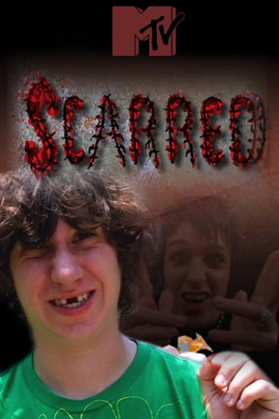 Scarred - Season 1